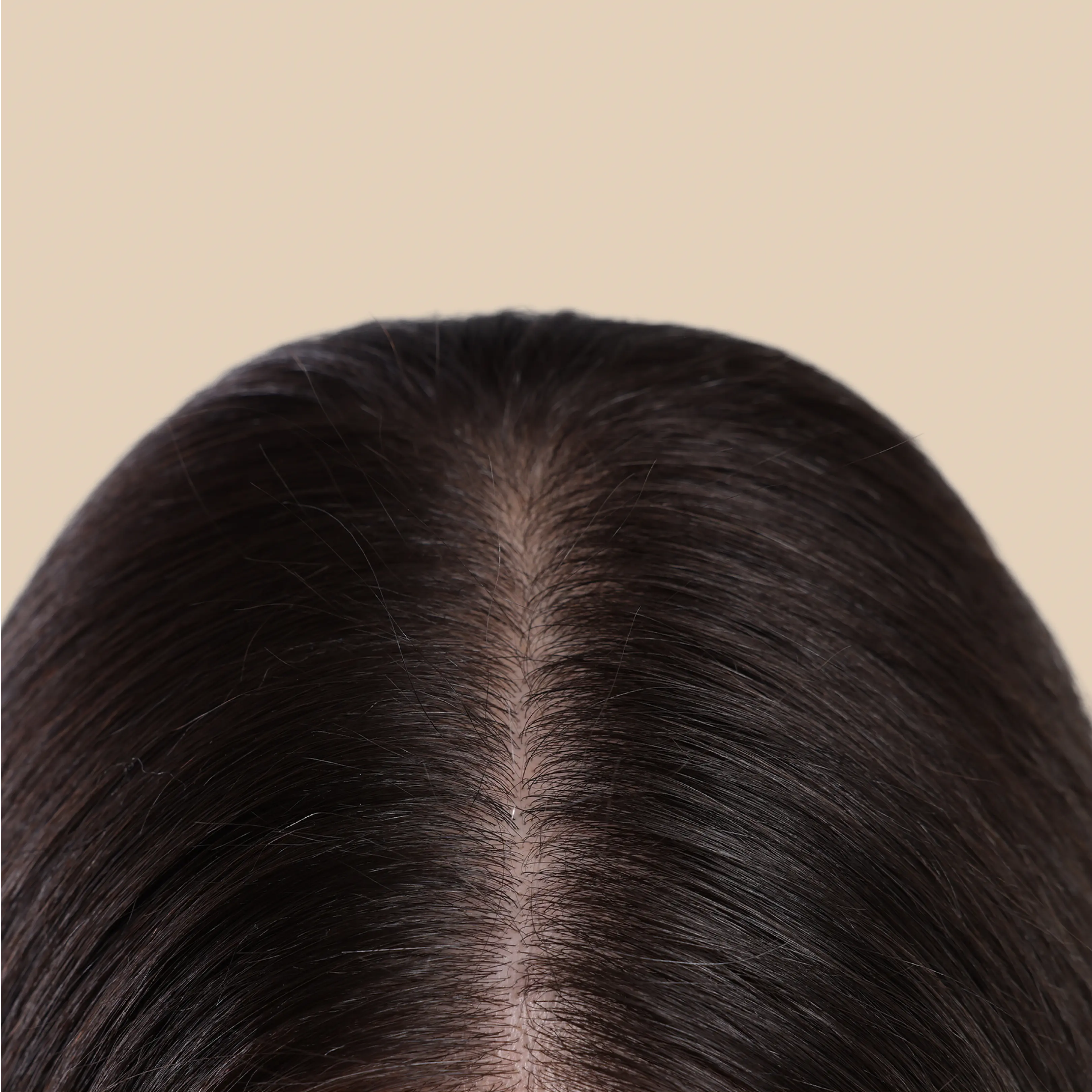After results of using Krti Herbals Anti Dandruff Oil showing flaky, irritated scalp