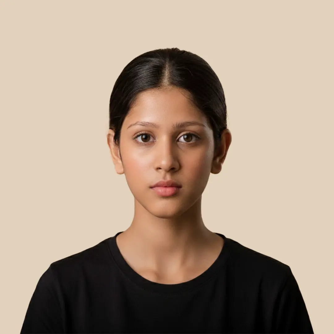 Before using Krti Herbals eyebrow growth oil roll showing acne-prone skin with blemishes